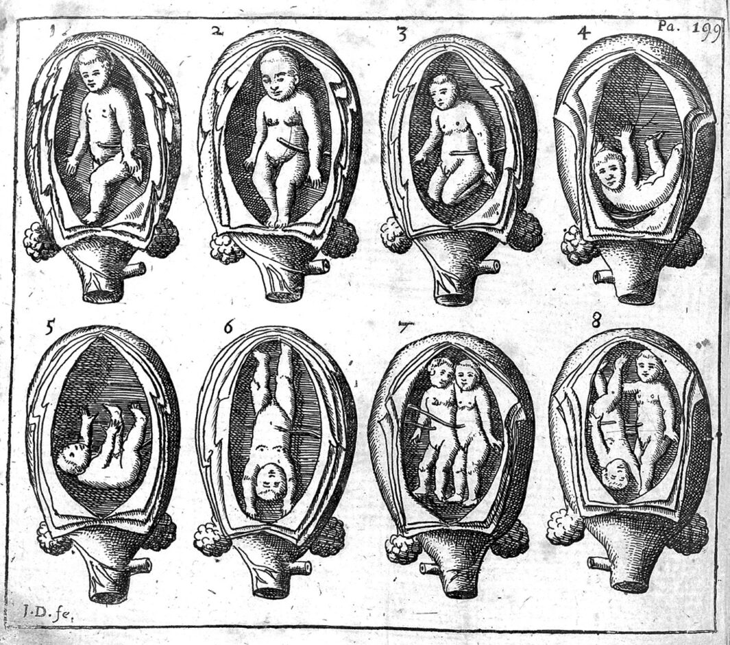 page of a midwife manual showcasing fetuses in the womb